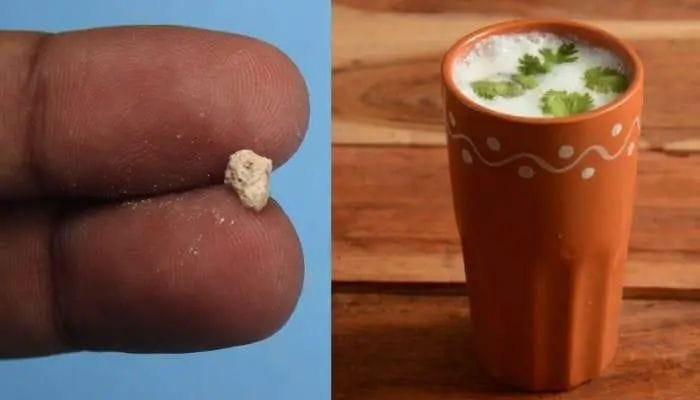 Uric acid
