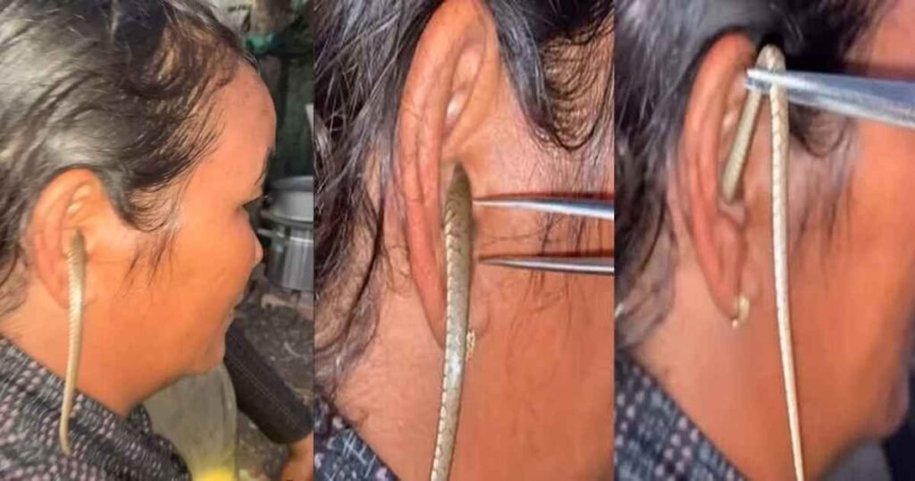 Snake in womans ear 1