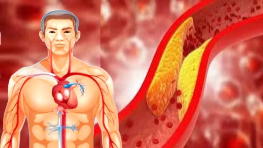 cholesterol