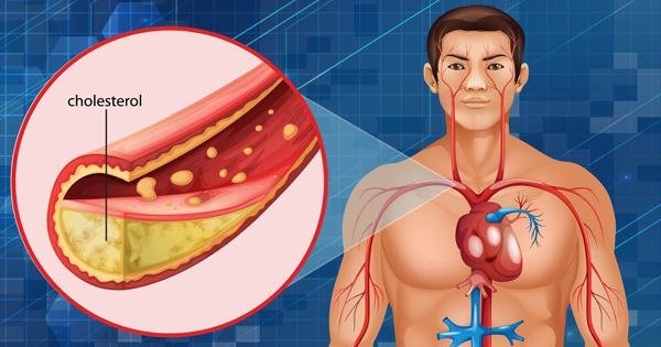 Cholesterol