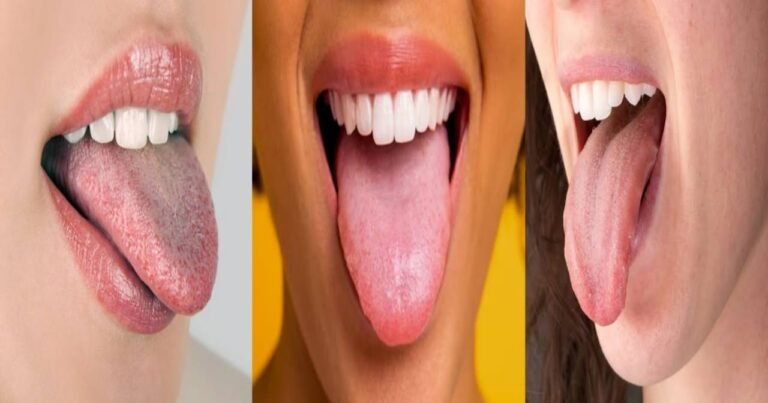 Tongue