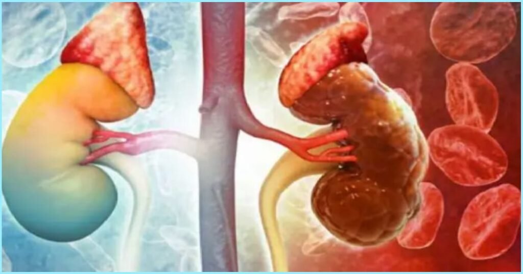 Kidney