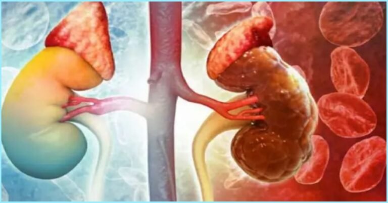 Kidney
