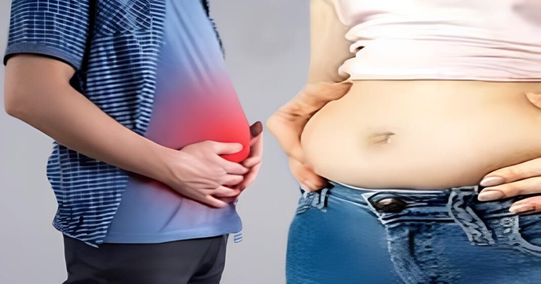 bloating stomach