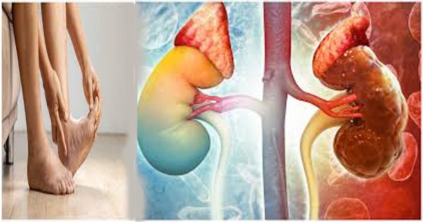Kidney 1