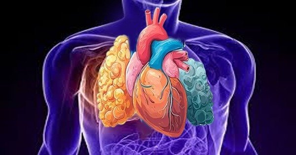 Lung cancer