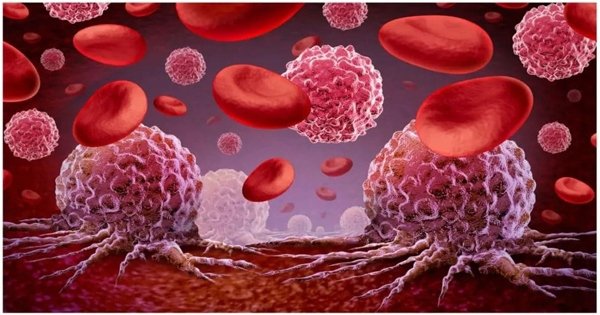 Blood cancer
