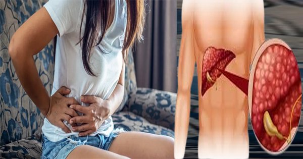 ಈ ಲಕ್ಷಣಗಳಿದ್ದರೆ ಅದು Liver Cancer ಆಗಿರಬಹುದು ; ತಕ್ಷಣ ವೈದ್ಯರನ್ನು ಸಂಪರ್ಕಿಸಿ.!