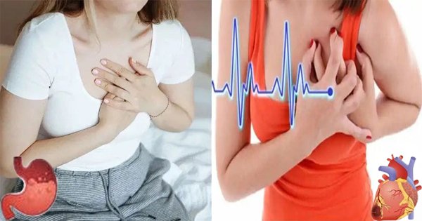 chest-pain