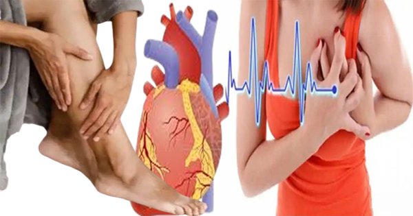 heart blockage