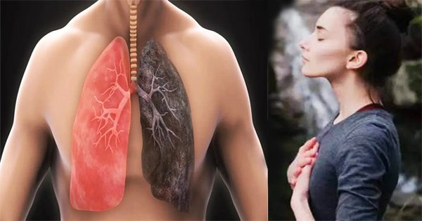 lung cancer