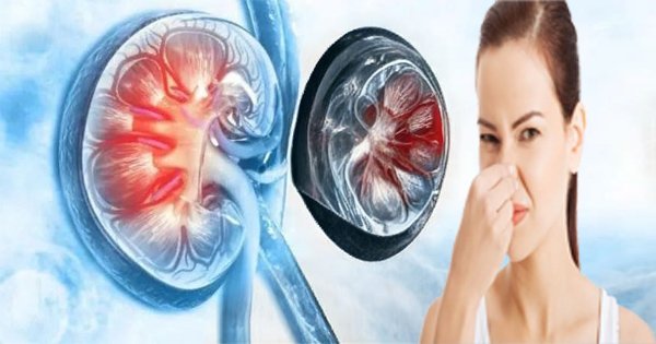 kidney damage