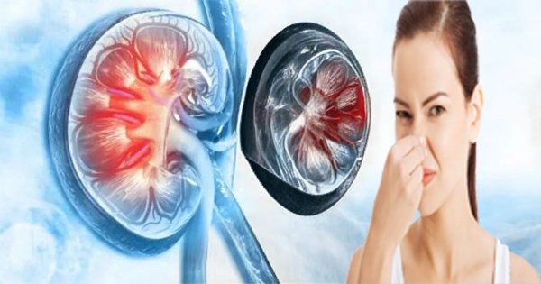 kidney damage