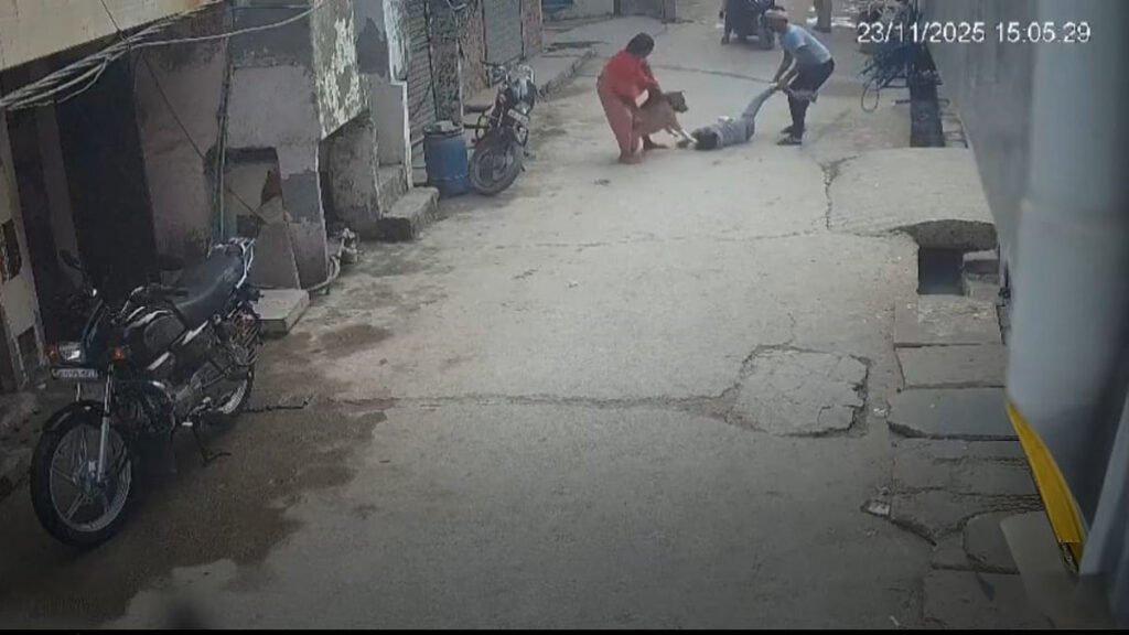 6 year old boy pitbull attack