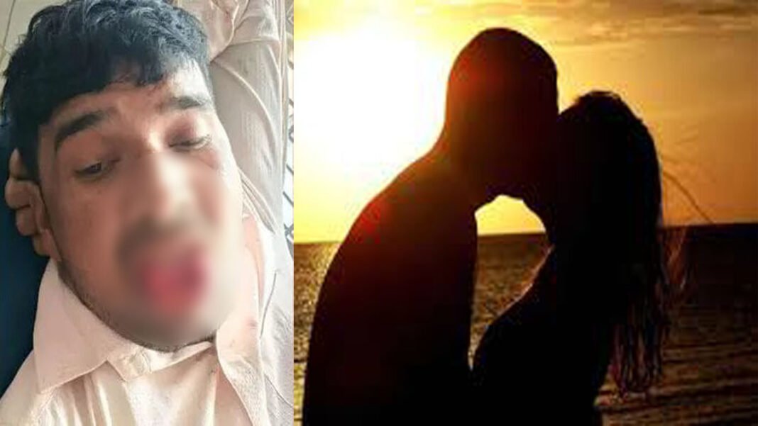 kiss-lover-tongue-bite-kanpur-incident