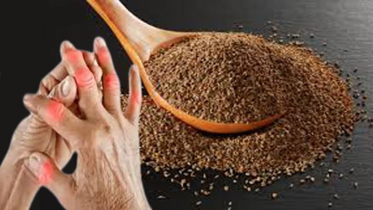 small-seed-uric-acid-kidney-stone