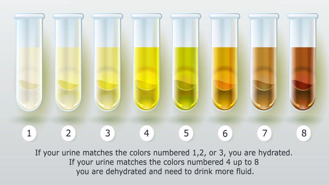 urine color : health warning signs