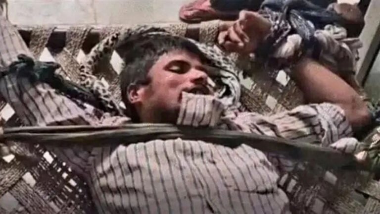 ನಾಯಿ ಕಚ್ಚಿದ ಕೆಲವೇ ಗಂಟೆಗಳಲ್ಲಿ ರೇಬೀಸ್‌ ಹೋಲುವ ಲಕ್ಷಣ