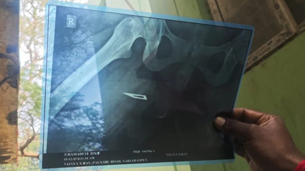 surgery blade left inside woman stomach doctor 1