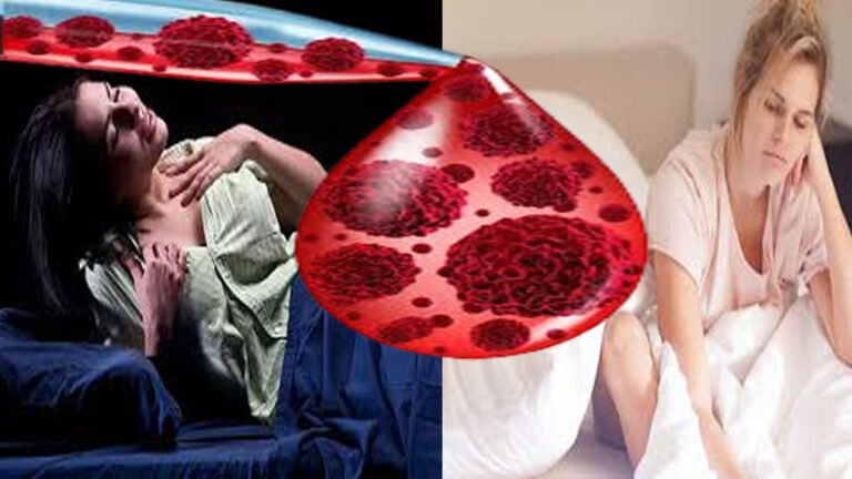 ರಾತ್ರಿ ಮಲಗುವಾಗ ಹೆಚ್ಚಾಗಿ ಬೆವರುವುದು ರಕ್ತದ ಕ್ಯಾನ್ಸರ್‌ನ ಆರಂಭಿಕ ಲಕ್ಷಣವೇ?