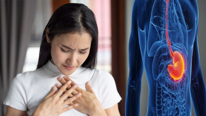 ಮಾತ್ರೆಗಳಿಲ್ಲದೇ ಎದೆಯುರಿ - ಗ್ಯಾಸ್ಟ್ರಿಕ್ ಸಮಸ್ಯೆಗೆ ಪರಿಹಾರ